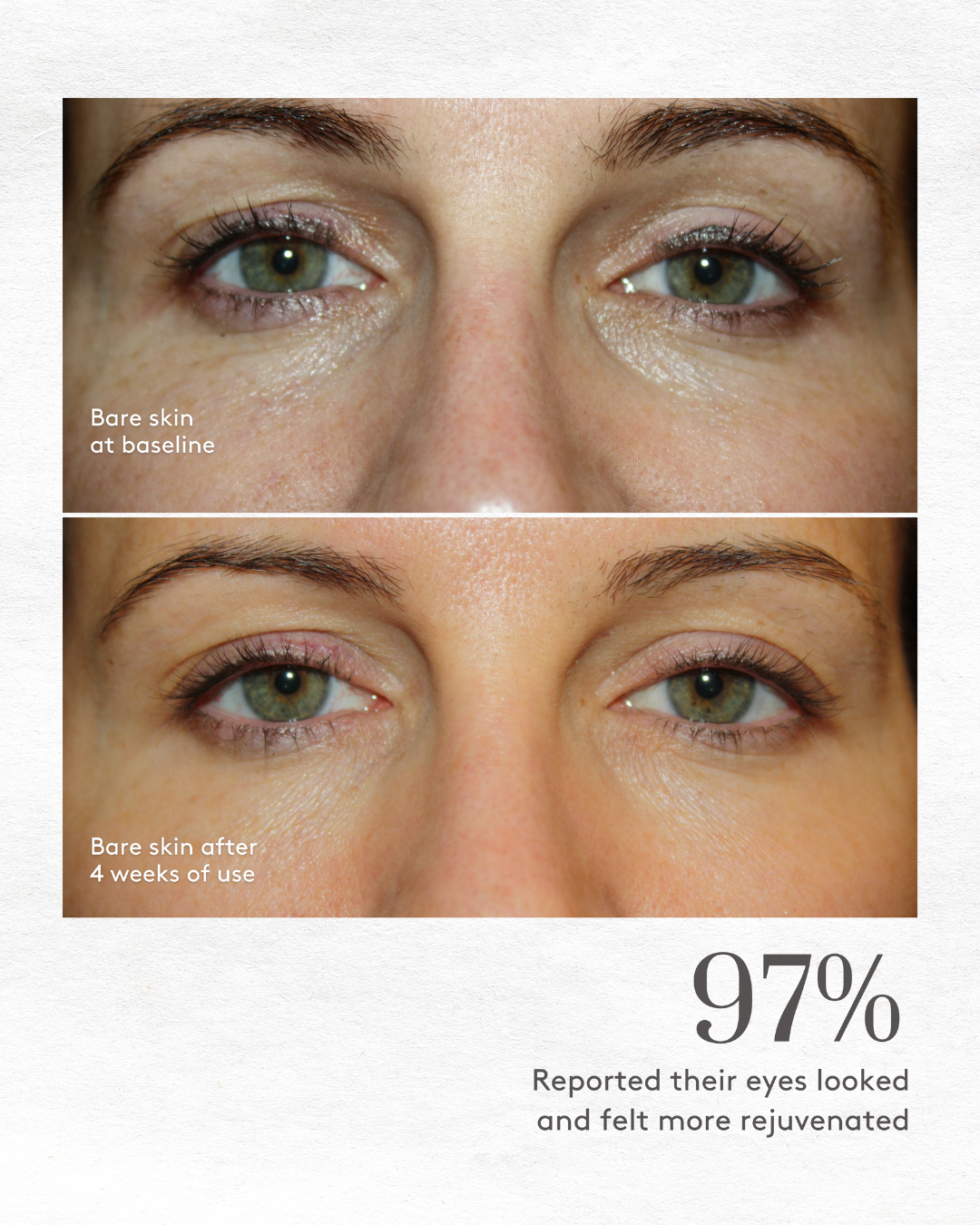 Total Eye 3-in-1 Renewal Therapy SPF 35