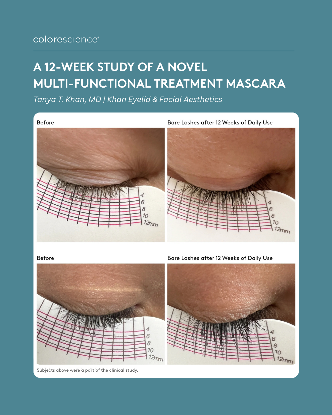 Total Lash Serum Mascara